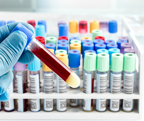 JCMC offers full laboratory services such as drug screening & a blood bank